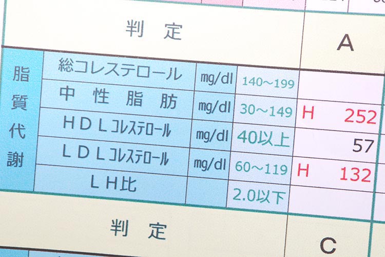脂質異常症画像