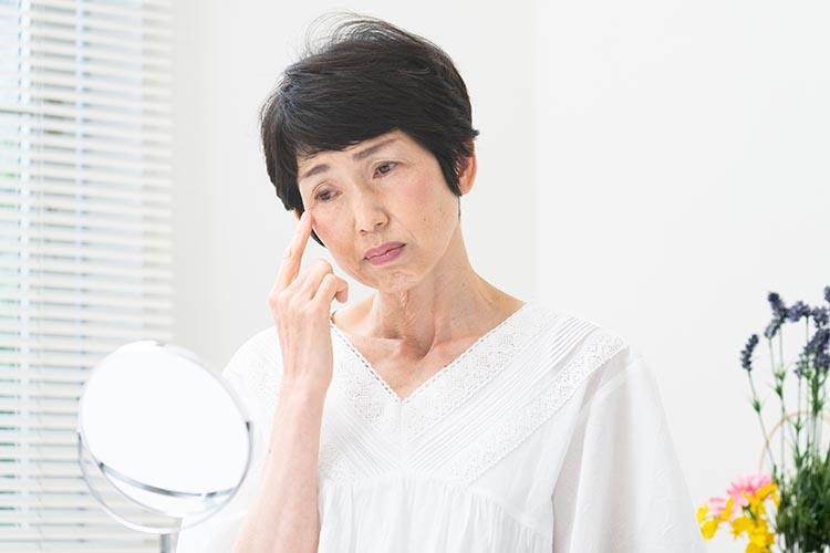 眼瞼下垂画像